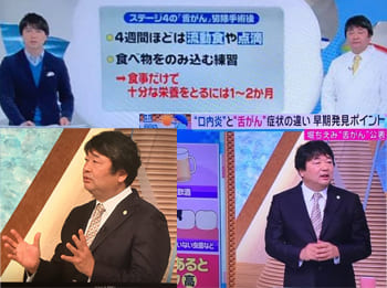 各テレビ局に「口腔がん解説」