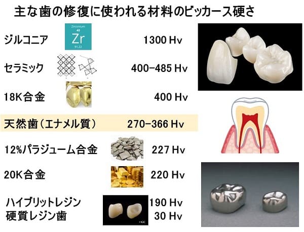 主な歯の修復に使われる材料のピッカース硬さ