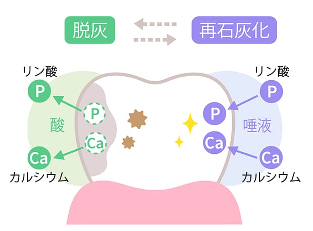 むし歯のメカニズムとは