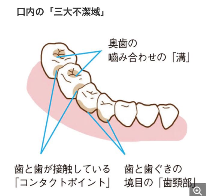 磨き残しが多いところを意識する