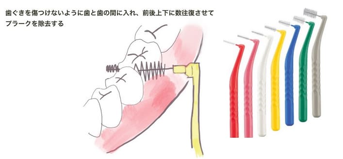 歯間ブラシの使い方