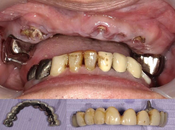 初診時の口腔内写真