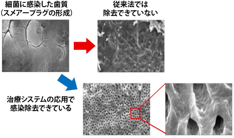 ウルトラデント社の治療システム