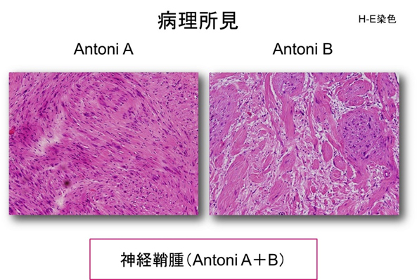 病理所見