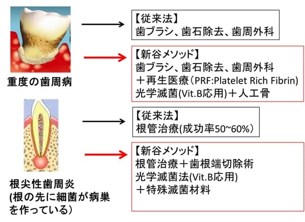 歯を抜く原因とその対策